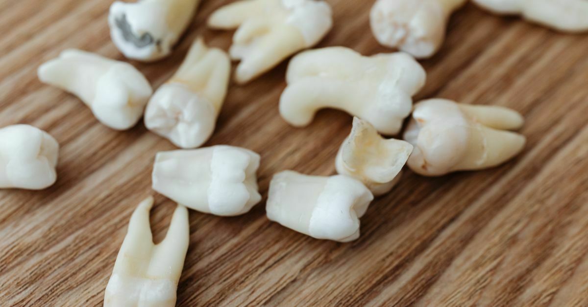 can-wisdom-teeth-grow-back-after-extraction