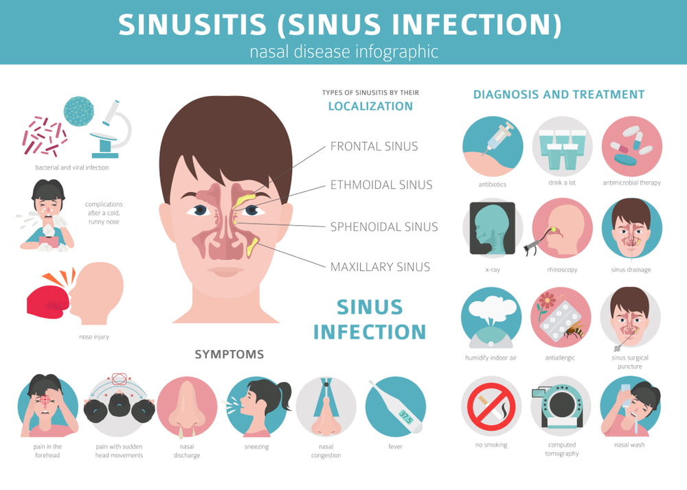 how-long-does-a-sinus-infection-last-medicalbuck