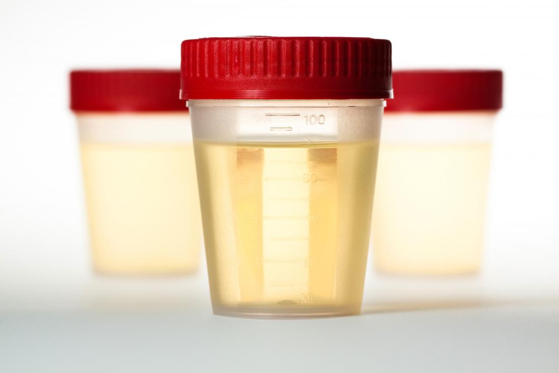 nitrates in urine